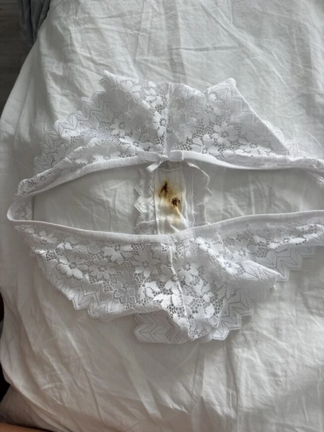 Culotte trace anale