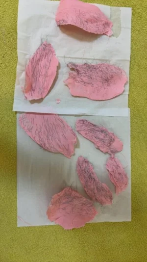 Poils pubiens sur bande de cire