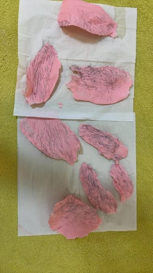 Poils pubiens sur bande de cire
